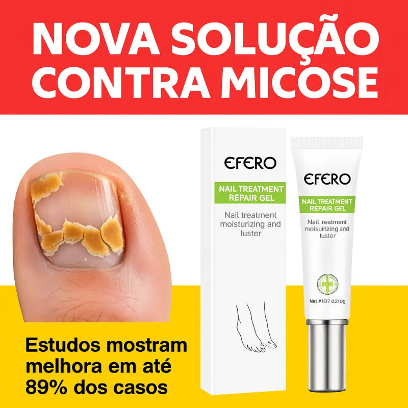 Efero Nail Repair – Gel para Fungos e Micose nas Unhas | Kaype Store