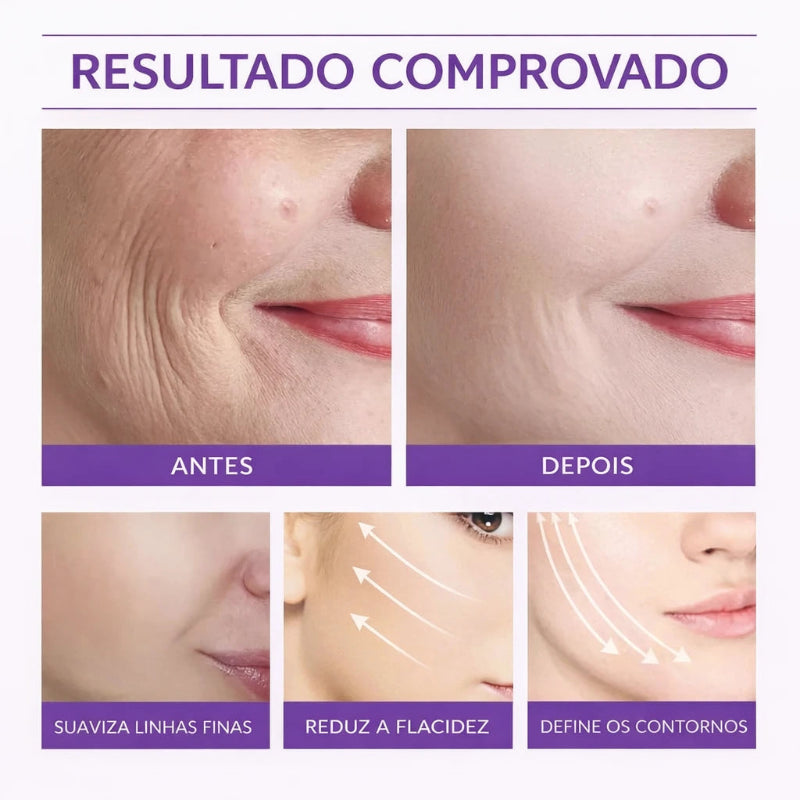 Fita Adesiva para Lifting Facial Invisível | Efeito Instantâneo – Kaype Store