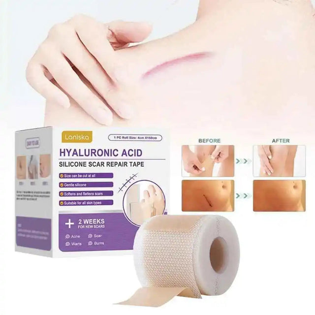 Fita Reparadora de Microagulhas com Ácido Hialurônico – Remove Cicatrizes, Estrias e Manchas