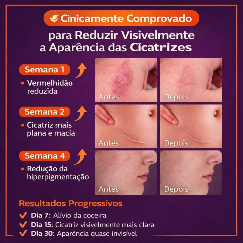 Scar Removal Cream — Creme para Cicatrizes Rosto e Corpo | Recuperação Avançada (30g)