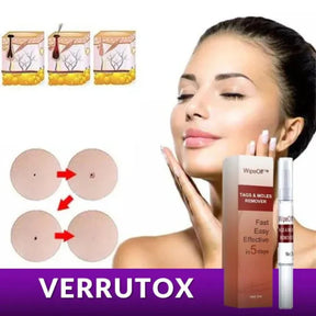 Verrutox - Removedor de Verrugas, Marcas e Manchas | Solução Eficaz e Sem Dor