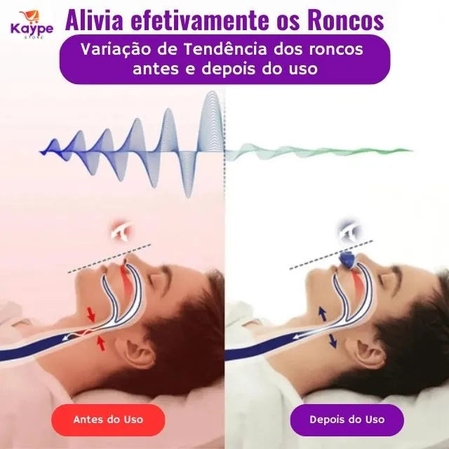 Anti Ronco Eletrônico Micro-CPAP - Sem tubo, Sem Máscara e Sem fios - SleepGuardian SA021 Kaypestore 