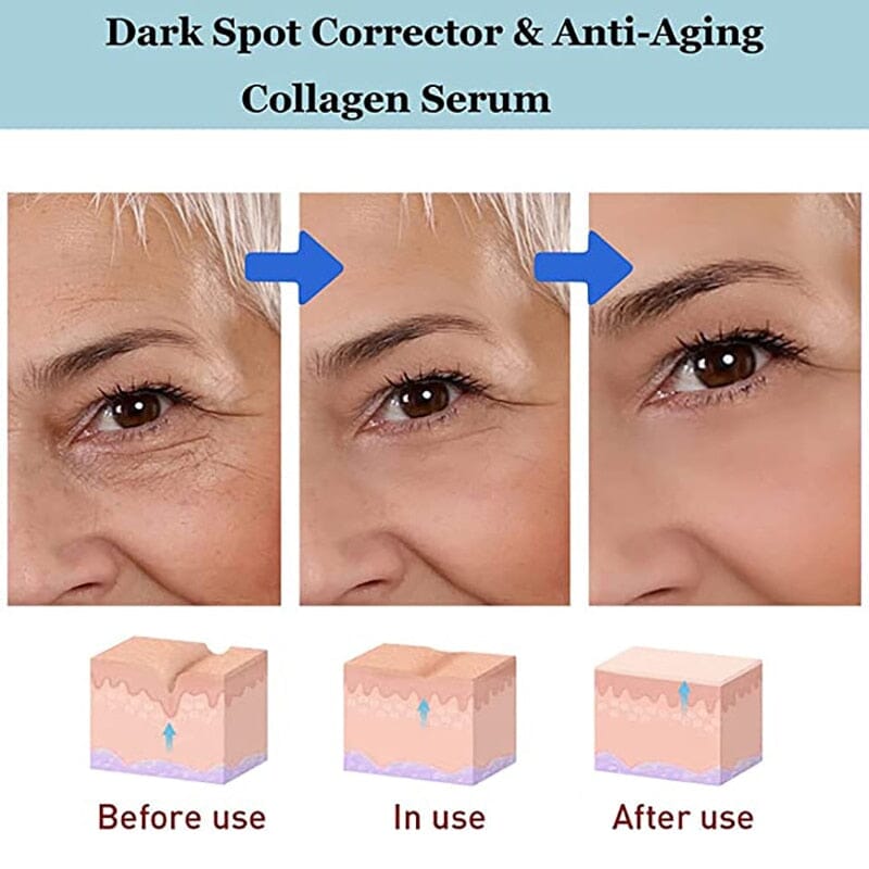 Creme Clareador Anti Olheiras Bolsas Para Os Olhos 0 Loja 