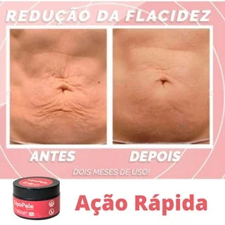 Creme Redutor de Flacidez Kaypestore 