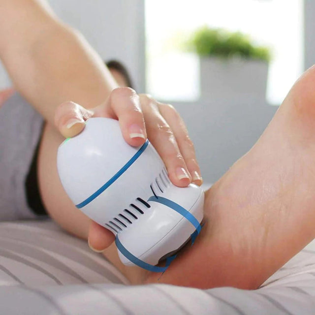 Esfoliador Elétrico Removedor de Calos e Rachaduras para os Pés BL010 Kaypestore 