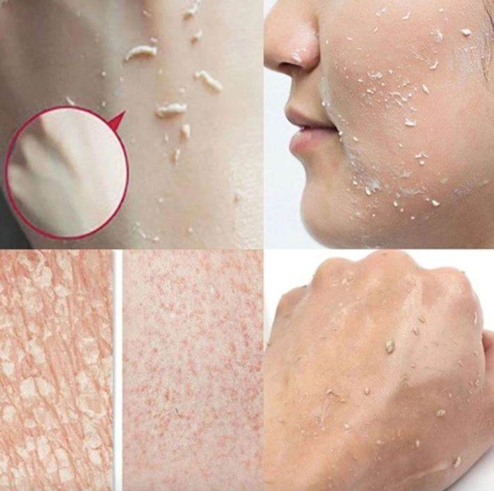 Gel Para Esfoliação e Clareamento Natural da Virilha, Axila e Rosto Com Extrato de Mamão Papaya - Skinetic BL031 Kaypestore 