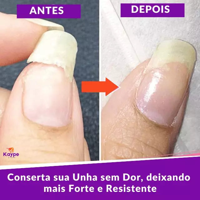 Geltox - Gel de Blindagem e Reparação de Unha (COMPRE 1, LEVE OUTRO) +1 Curso de Unhas Decorativas Kaypestore 
