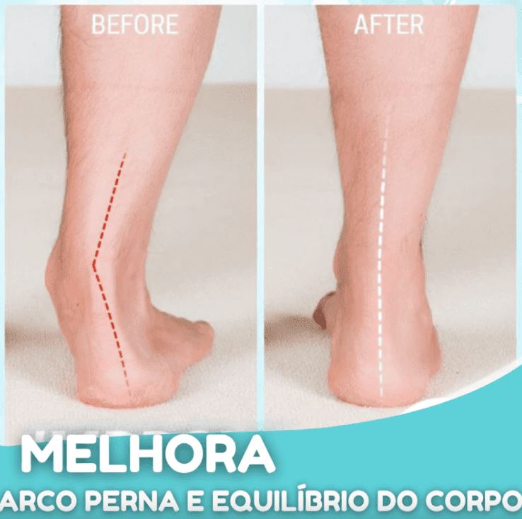 JoanettOriginal - Corretor Ortopédico de Joanetes e Pé Chato (2 Peças) ORT008 Kaypestore 