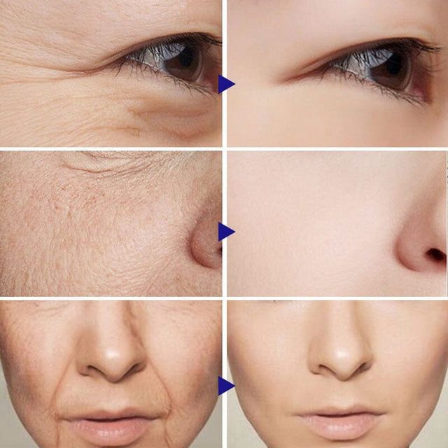 Sérum Retinol Anti-Rugas Combate Linhas De Expressão, olheiras, Flacidez e Viço - Kaype Store