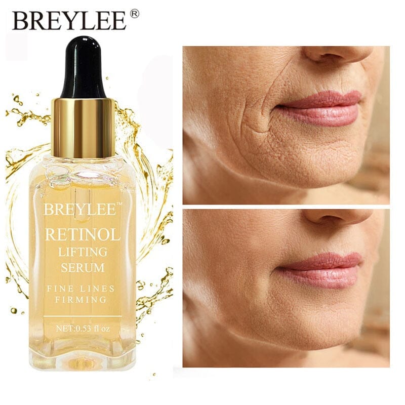 Sérum Retinol Anti-Rugas Combate Linhas De Expressão, olheiras, Flacidez e Viço - Kaype Store
