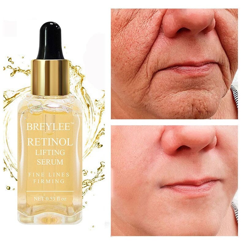 Sérum Retinol Anti-Rugas Combate Linhas De Expressão, olheiras, Flacidez e Viço - Kaype Store
