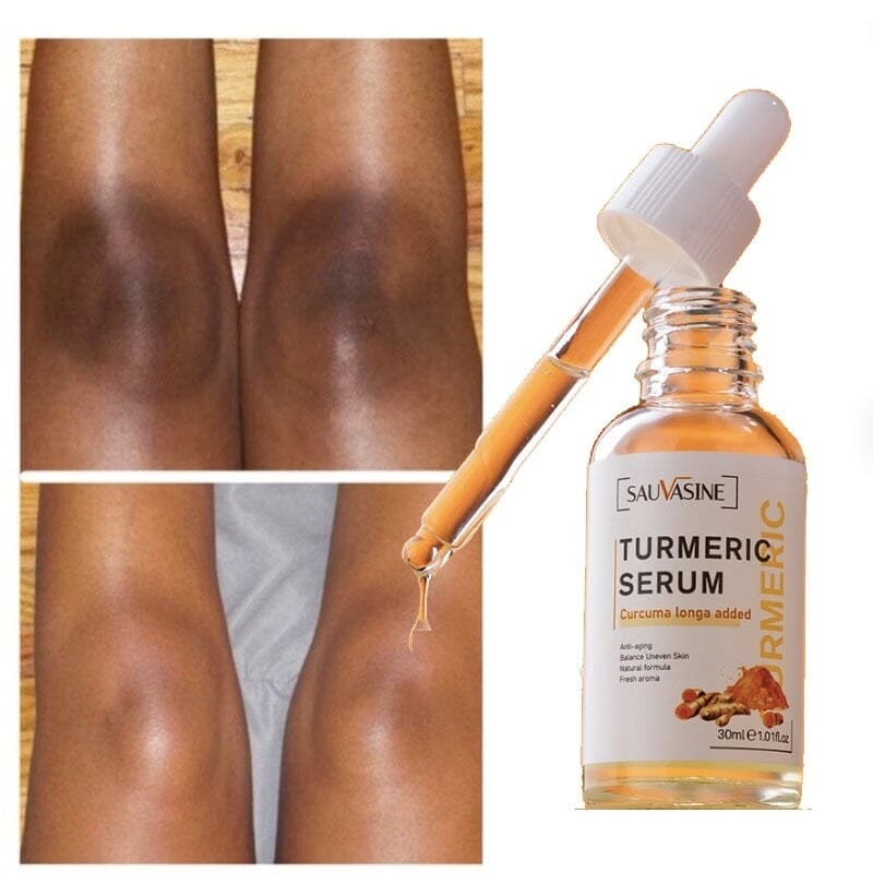 Skin Clear - Sérum Clareador de Melasmas e Manchas na Pele 365 Loja 
