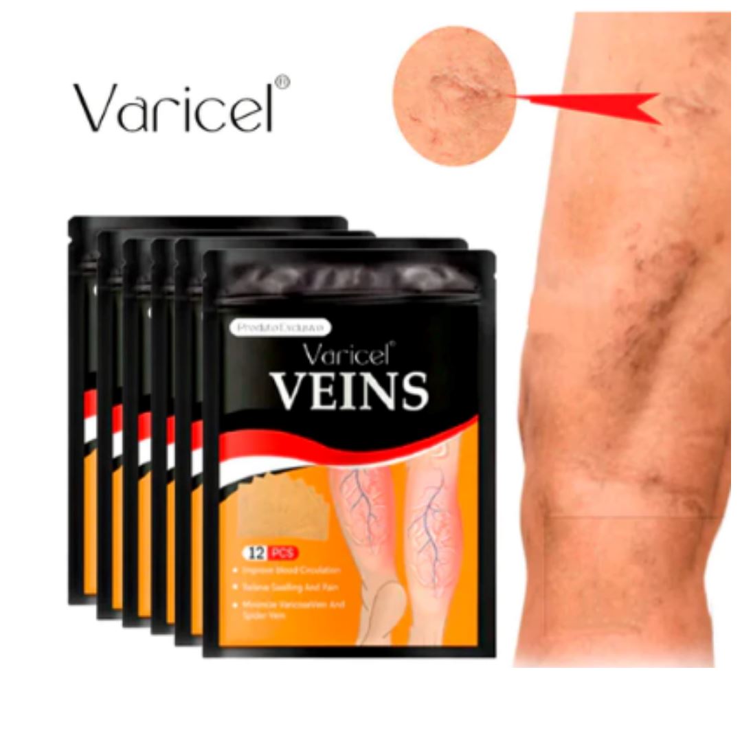 VARICEL ORIGINAL (VaricosaMax) - Adesivo de Varizes, Dores nas Pernas, Joelho e Ciatico SA010 / ORT022 Kaypestore 